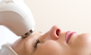 Radiant Skin Awaits: 60 or 90-Minute Diamond Microdermabrasion Facial 