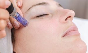 Microlifting facial de vitaminas con Dermapen en PF Bienestar Microlifting facial de vitaminas con Dermapen en PF Bienestar