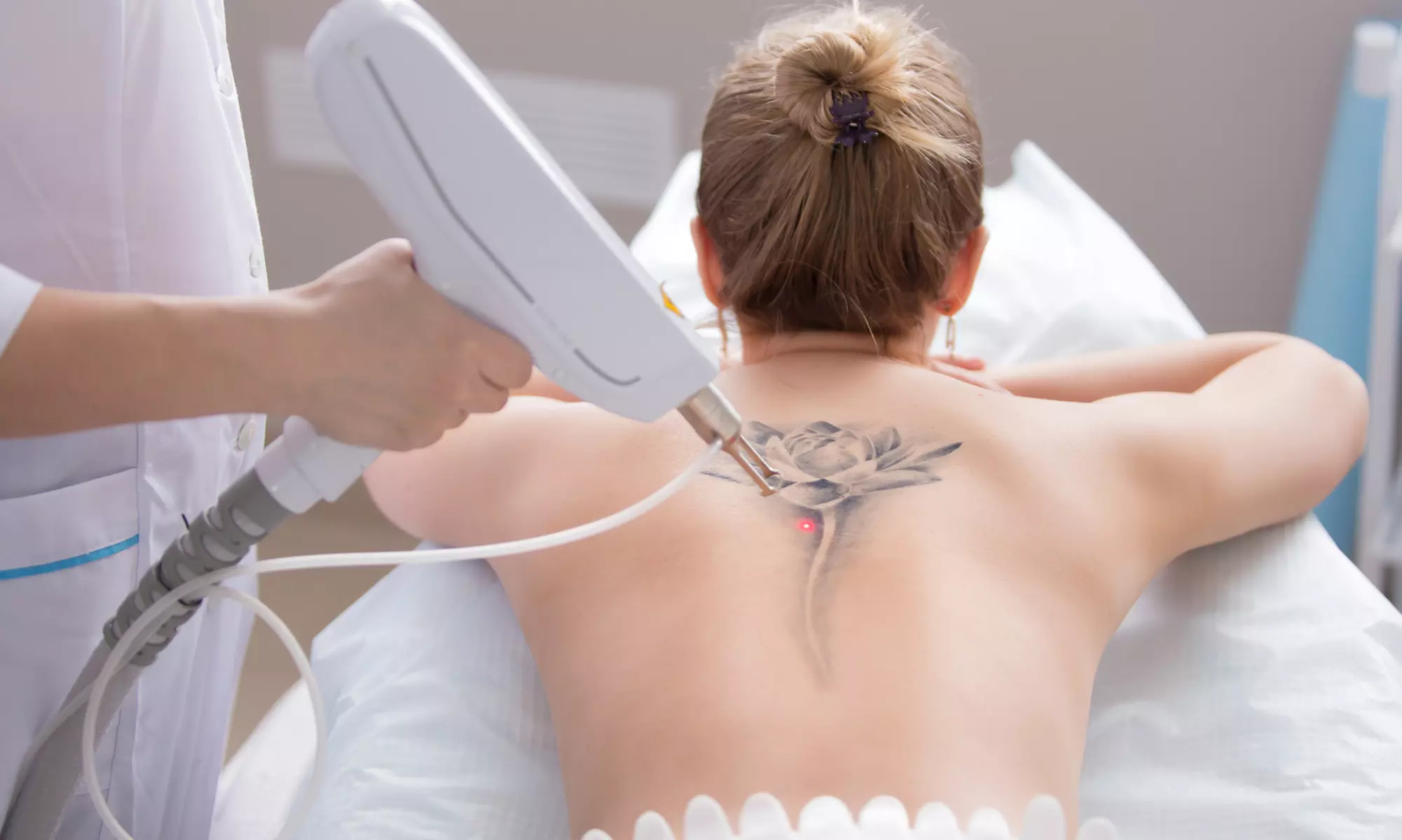 Hasta 81% de dto. en Eliminación de tatuajes en Centro de Estética Avanzada True