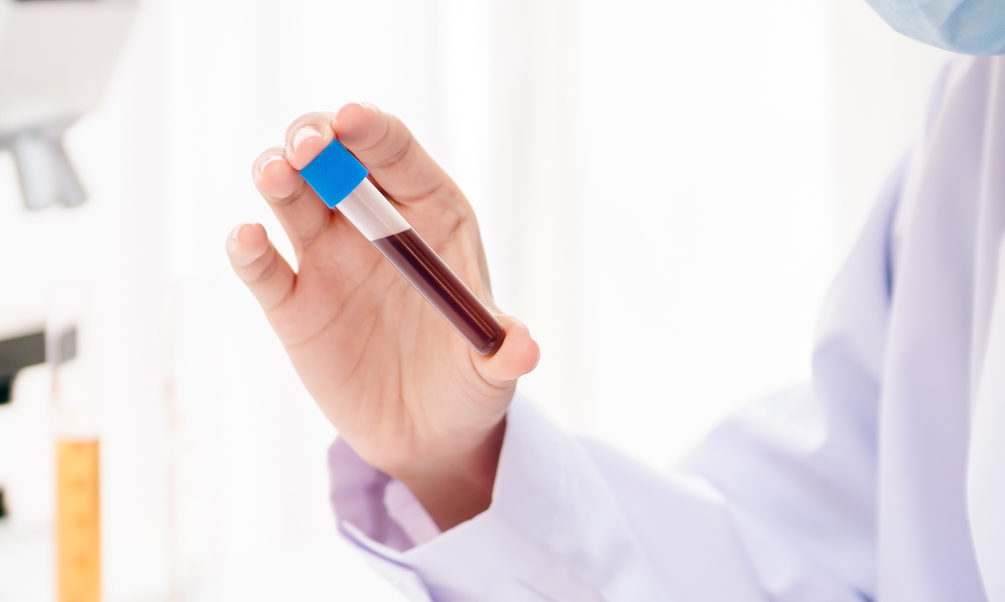 Kurs online: Diagnostyka laboratoryjna w dietetyce