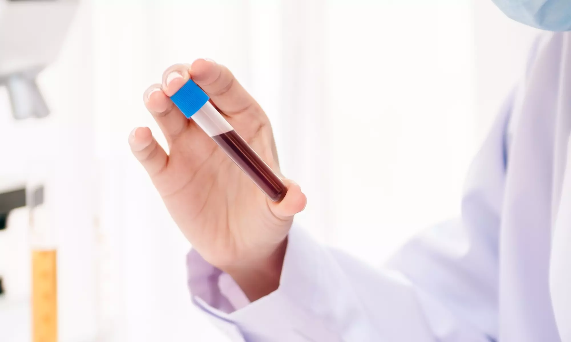 Kurs online: Diagnostyka laboratoryjna w dietetyce z Dietetycznie Poprawni (do -70%) - Primary Image