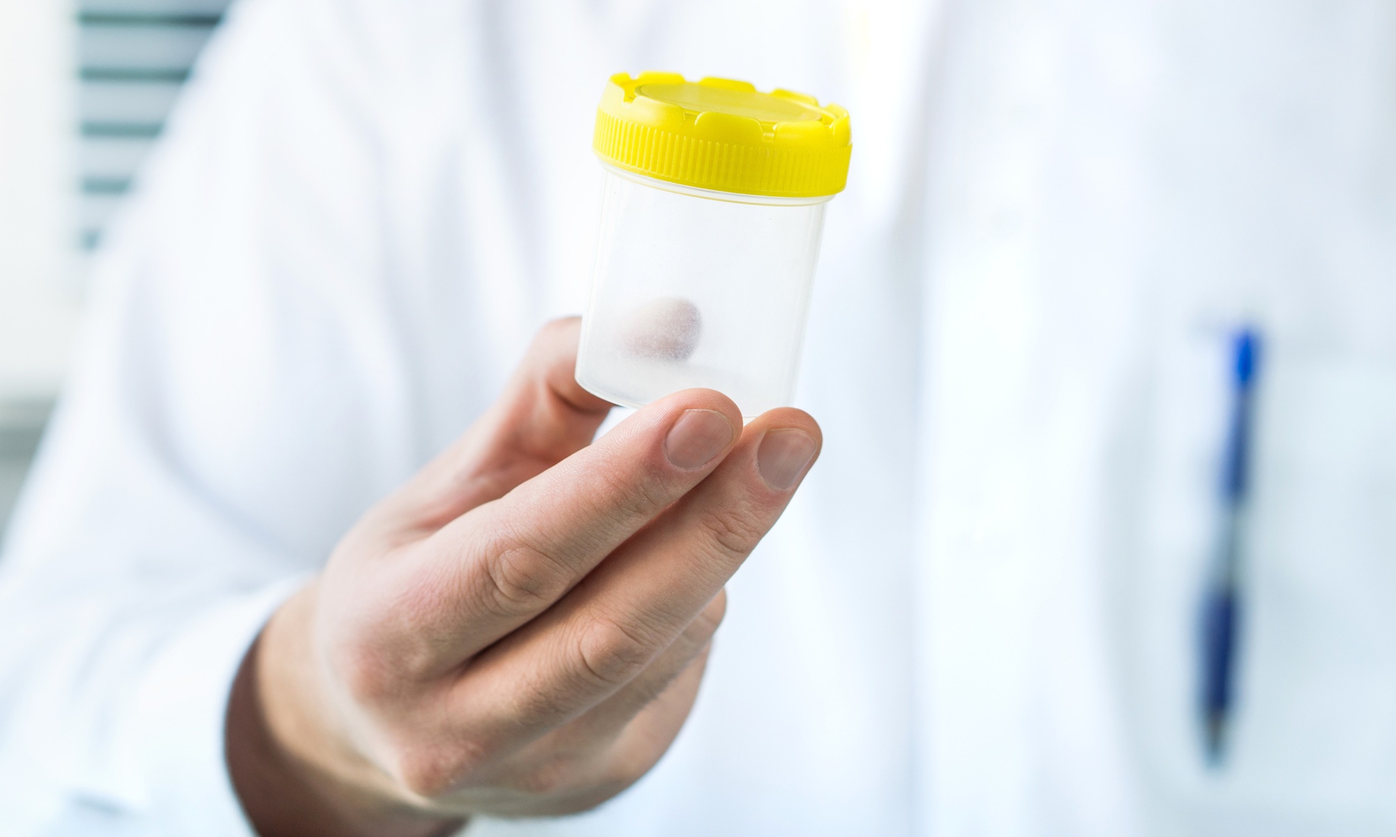 Ensure Safety w/ 5 Panel Urine or DOT Drug Screen / Non Legal DNA Test