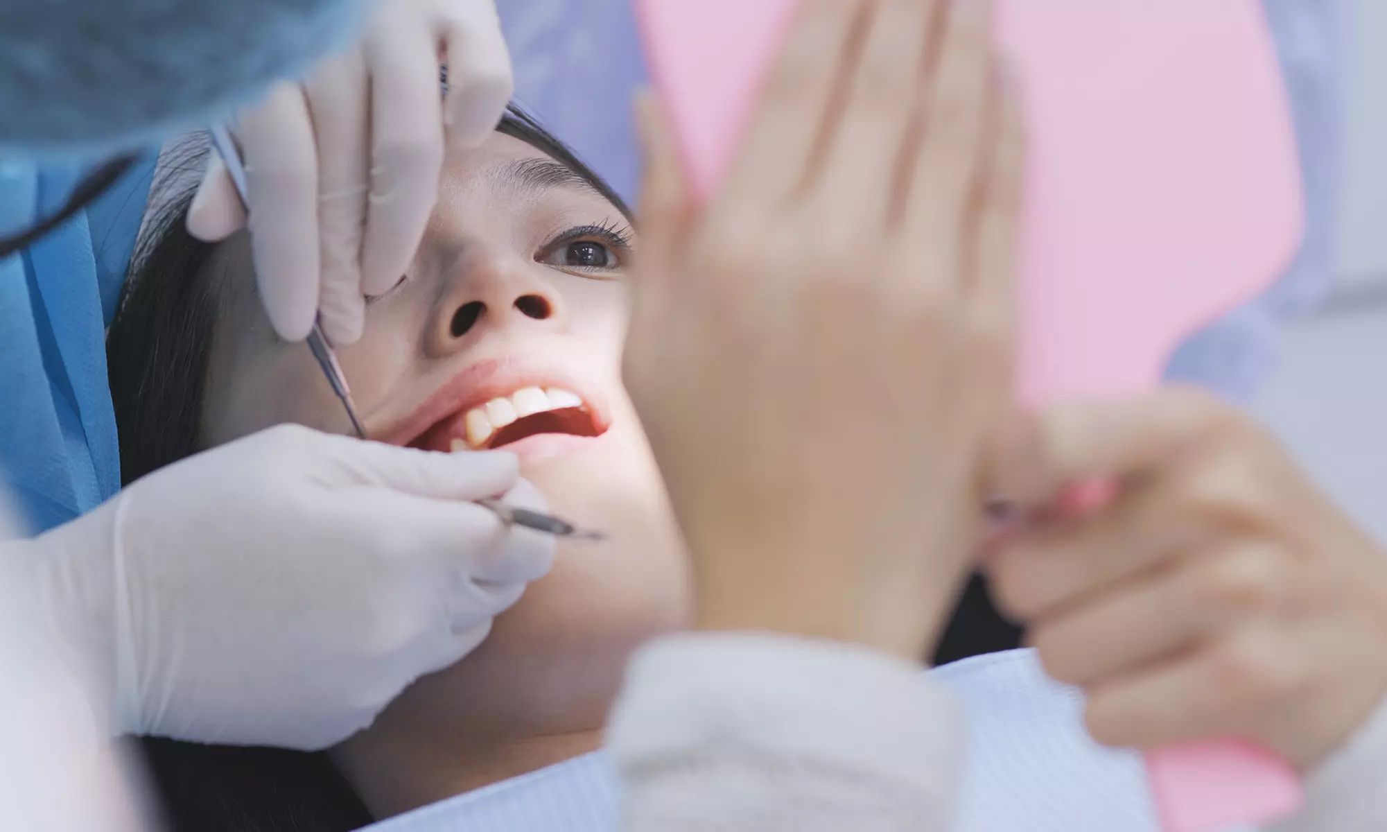 Limpieza bucal con revisión y opción a limpieza de 2 o 4 cuadrantes