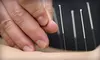$29 for Assessment and One Session of Acupuncture or Laser Therapy at Back 'n Motion ($70 Value)