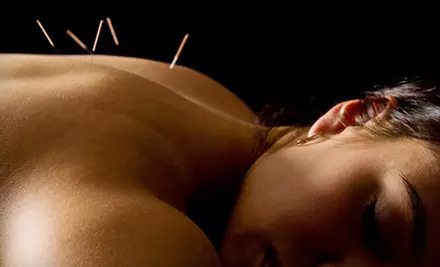 $30 for Introductory Acupuncture Session from Ellen Ona, L.Ac. in Bethel Park ($70 Value) - Primary Image