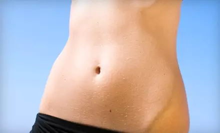 $185 for Two VelaShape Treatments at Fusion Medical Spa in Naperville ($800 Value) - Primary Image