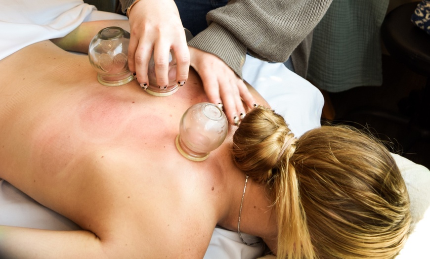 Image 3: Acupuncture Visits: Initial Consultation, Follow-Ups & 3-Session Packs