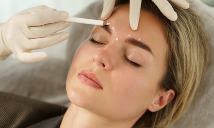 Tratamiento reafirmante inyectado efecto lifting en patas de gallo, entrecejo y frente - AJ Estetic