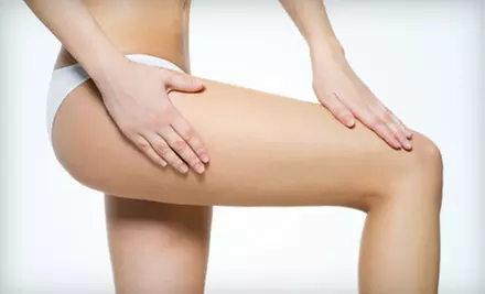 Two Laser Spider-Vein Treatments or One Sclerotherapy Session at Luxor Medical Spa in Huntington Beach (Up to 75% Off)  - Primary Image
