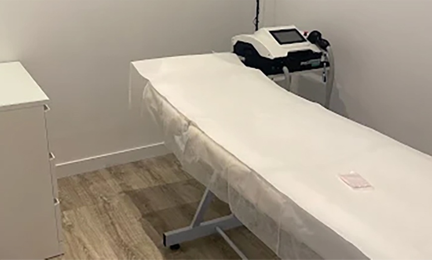 Image 7: Microdermoabrasión con punta de diamante en Cuídate Majadahonda