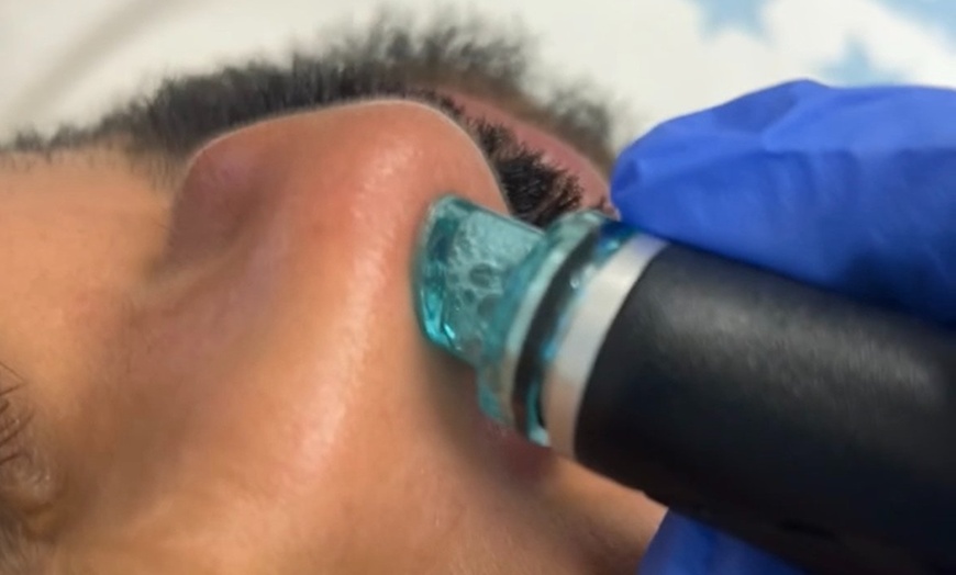 Image 4: Radiant Skin Awaits: Signature & Platinum Hydrafacial Packages