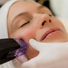 Image 2: Advanced Morpheus8 & PRP Micro needling for Deep Skin Remodeling