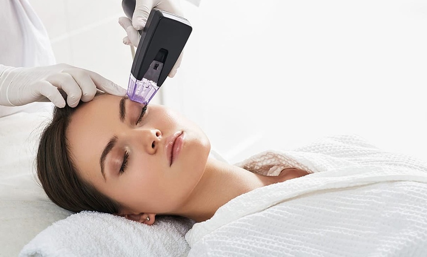 Image 2: Lumecca Laser IPL Treatments for Face, Neck & Chest