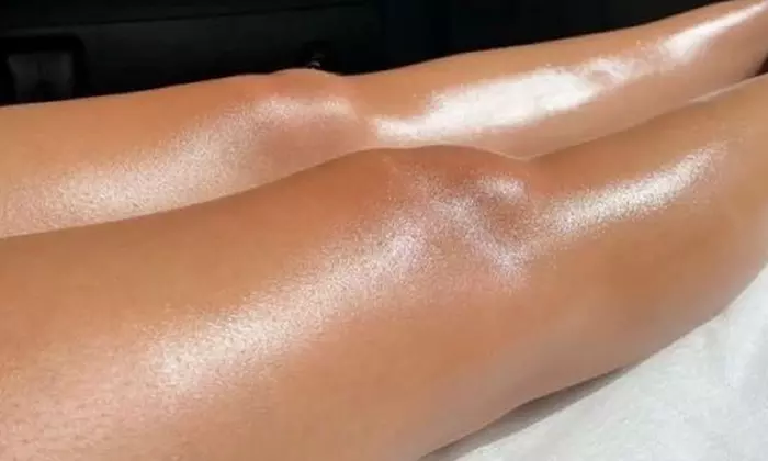 Up to 88% Off on Six Sessions of Laser Hair Removal for Small, Medium, or Large Areas at Mirror Mirror Esthetics - Primary Image