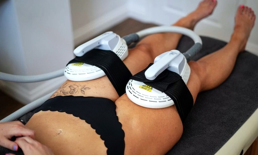 Image 2: Transform Your Body with Suprasculpt: EMS Body Sculpting Treatment
