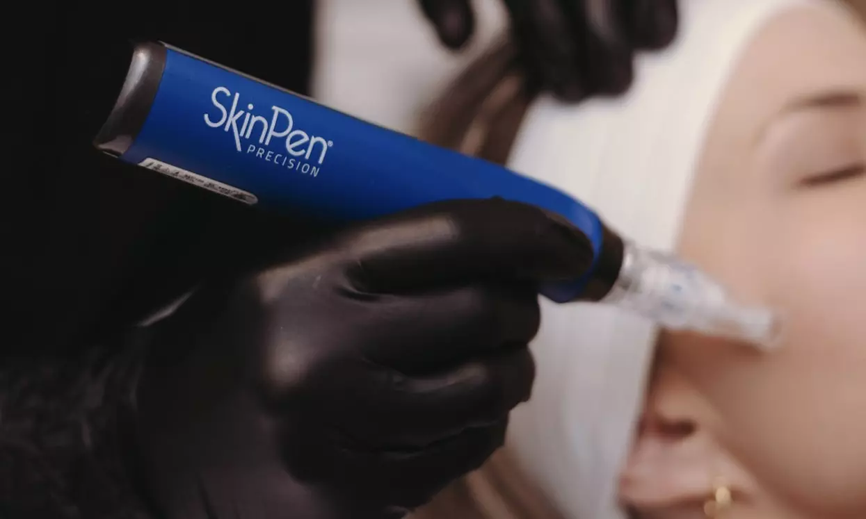 Refresh your Skin with PRF Injection, PRP Facial, or Vampire Face Lift 