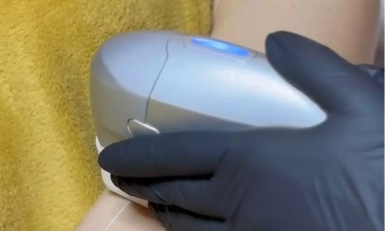 Zachowaj młodość dzięki nowoczesnym zabiegom systemem HIFU