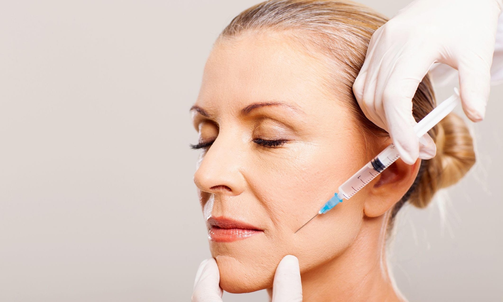 1 mL Syringe of Revanesse Versa for Wrinkle Reduction
