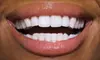 $179 for a Zoom! Teeth-Whitening Treatment at Boain Dental Care in Florissant ($550 Value)