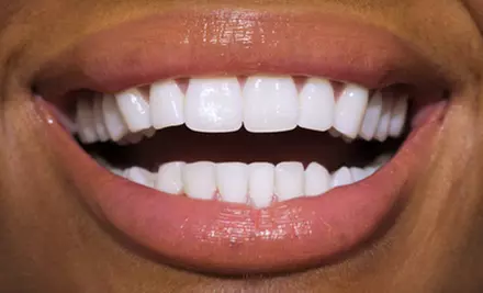 $179 for a Zoom! Teeth-Whitening Treatment at Boain Dental Care in Florissant ($550 Value) - Primary Image
