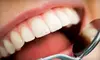 $29 for Cleaning, Exam, and X-Rays ($445 Value) or $129 for Zoom! whitening ($600 Value) at Smiles West Dental. Two Locations Available. 