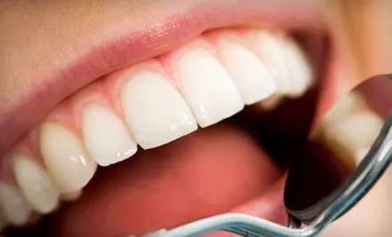 $29 for Cleaning, Exam, and X-Rays ($445 Value) or $129 for Zoom! whitening ($600 Value) at Smiles West Dental. Two Locations Available.  - Primary Image