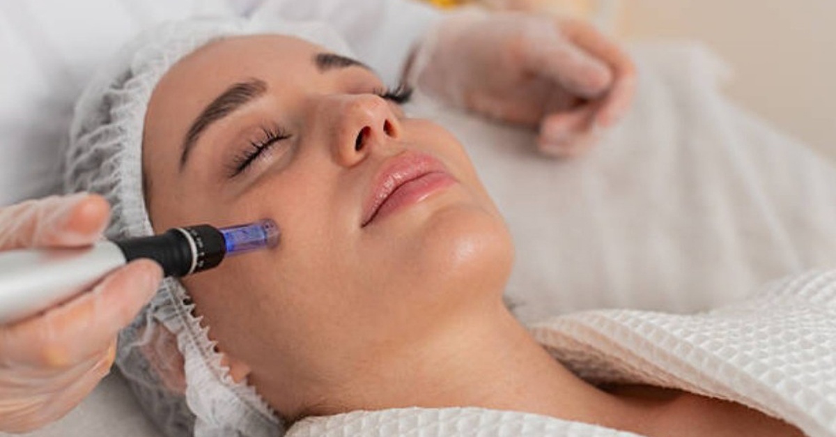 Tratamiento facial con Dermapen y mascarilla en Valencia