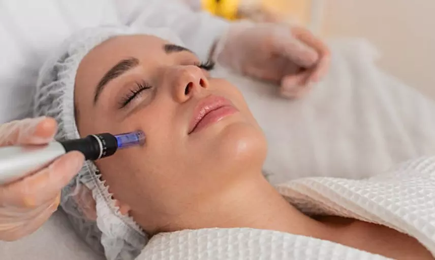 Tratamiento facial con Dermapen, mascarilla y opción a extras para 1