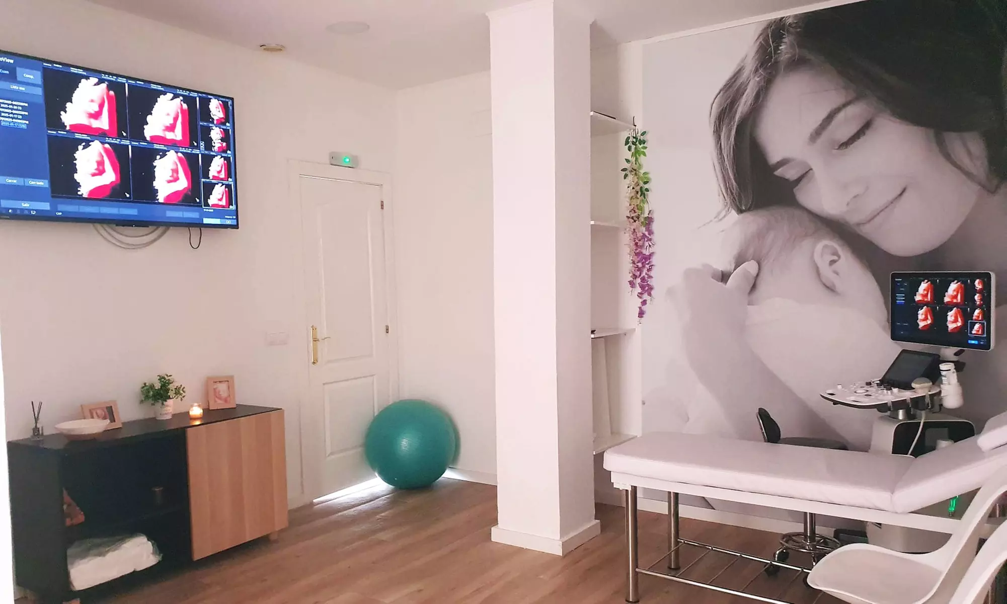 Ecografía ECO5D: Fotos, video y latido en tu móvil desde la semana 7