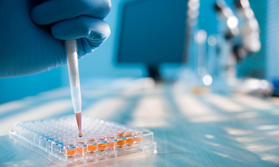 Descubre tus intolerancias alimentarias desde casa con Be Institute