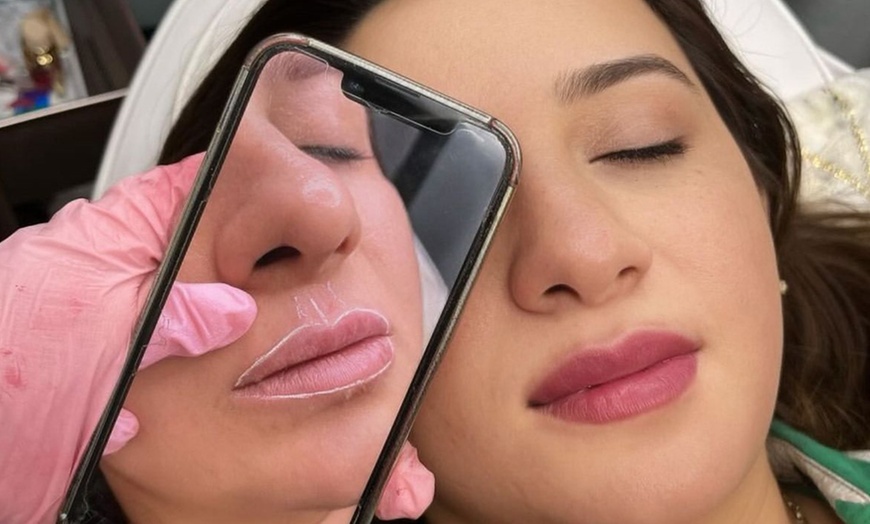 Image 1: Enhance with Lip Blush or Dark Lip Transformation with Consultation