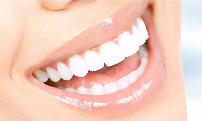 Scaling and Polishing with X-Ray at Omar Yahia Dental Surgery Clinic