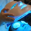 Image 9: Higiene facial, con microdermoabrasión, radiofrecuencia y máscara led