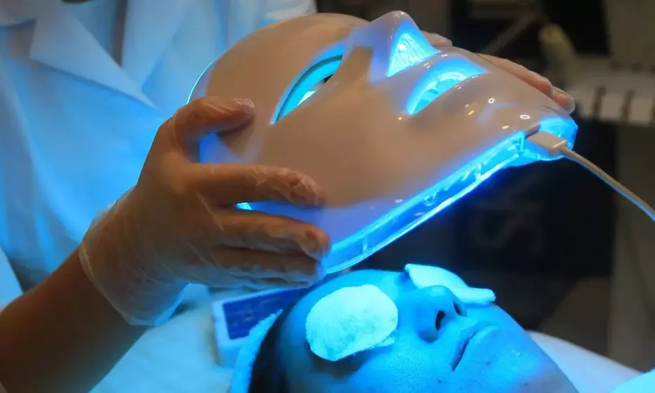 Higiene facial, con microdermoabrasión, radiofrecuencia y máscara led