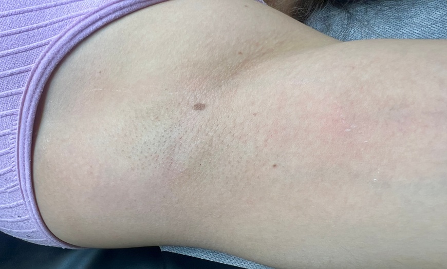 Image 5: Brazilian and Underarm Waxing