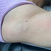 Image 5: Brazilian and Underarm Waxing
