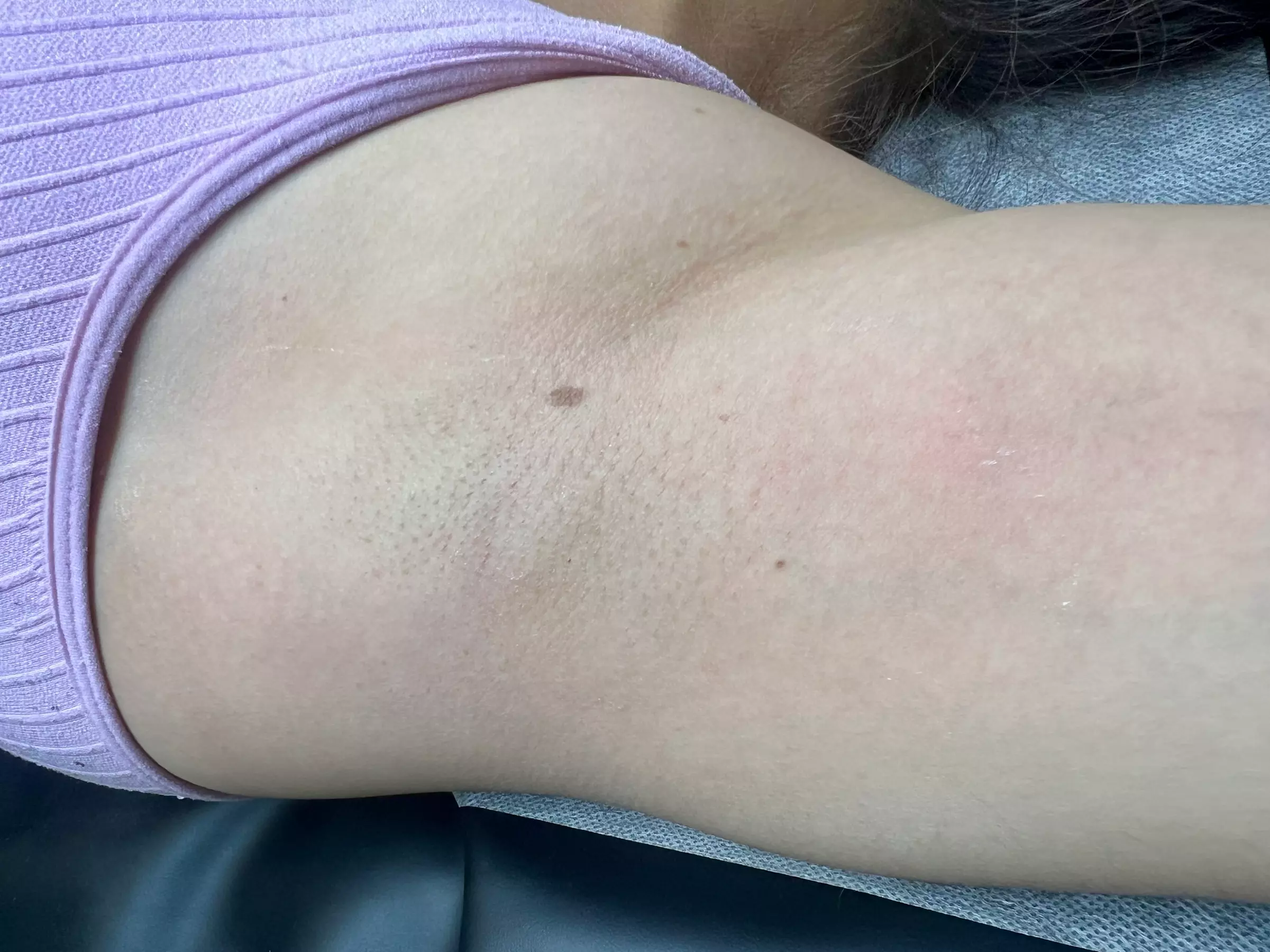 Brazilian and Underarm Waxing