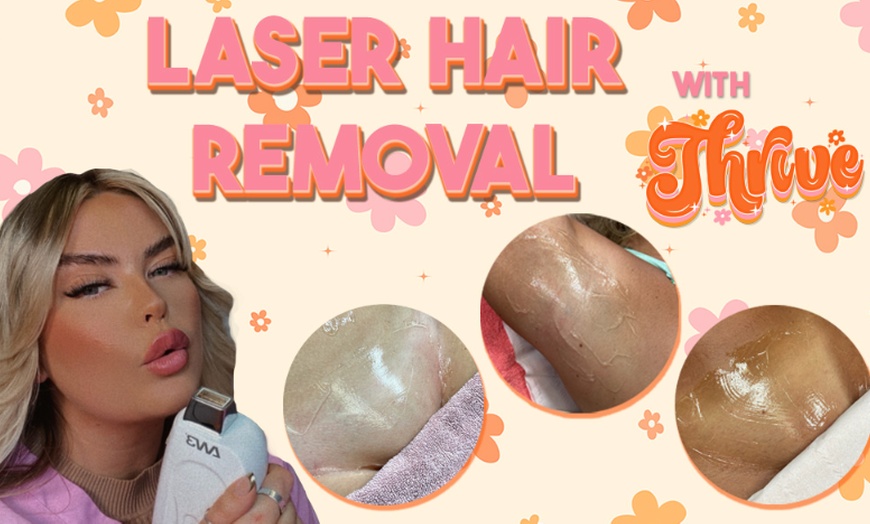 Image 2: Say No to Razor Burns with Laser Hair Removal at Thrive Aesthetics