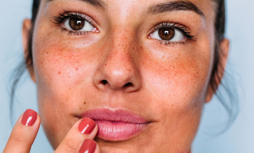 Image 2: Unlimited Full Face Xeomin on Sundays at June Skin