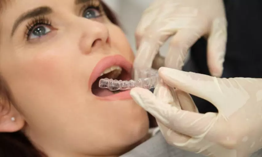 Férula de descarga y limpieza bucal