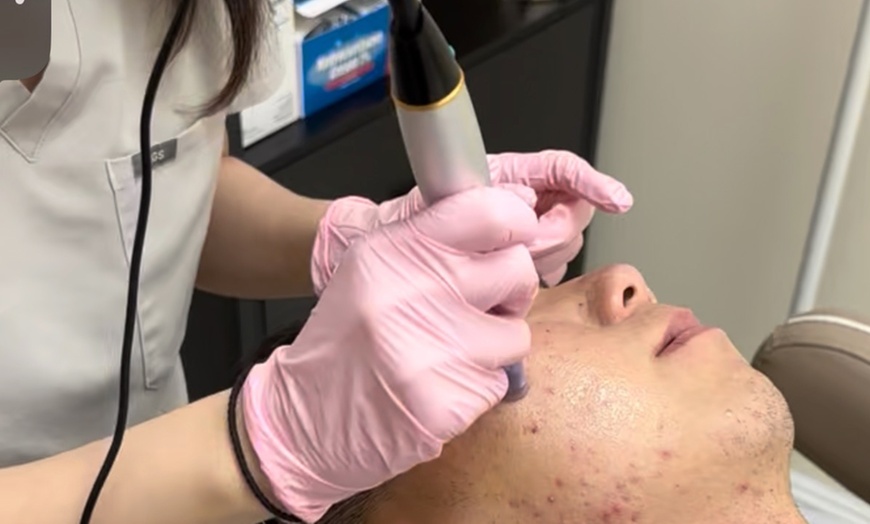 Image 1: Revitalize w/ 1 or 2 Sessions Platelet-Rich Plasma Facial Injections 