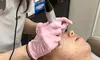Youthful Radiance with One or Two Sessions Platelet-Rich Plasma Facial Injections(Up to 62% Off) at VIQI Med Spa