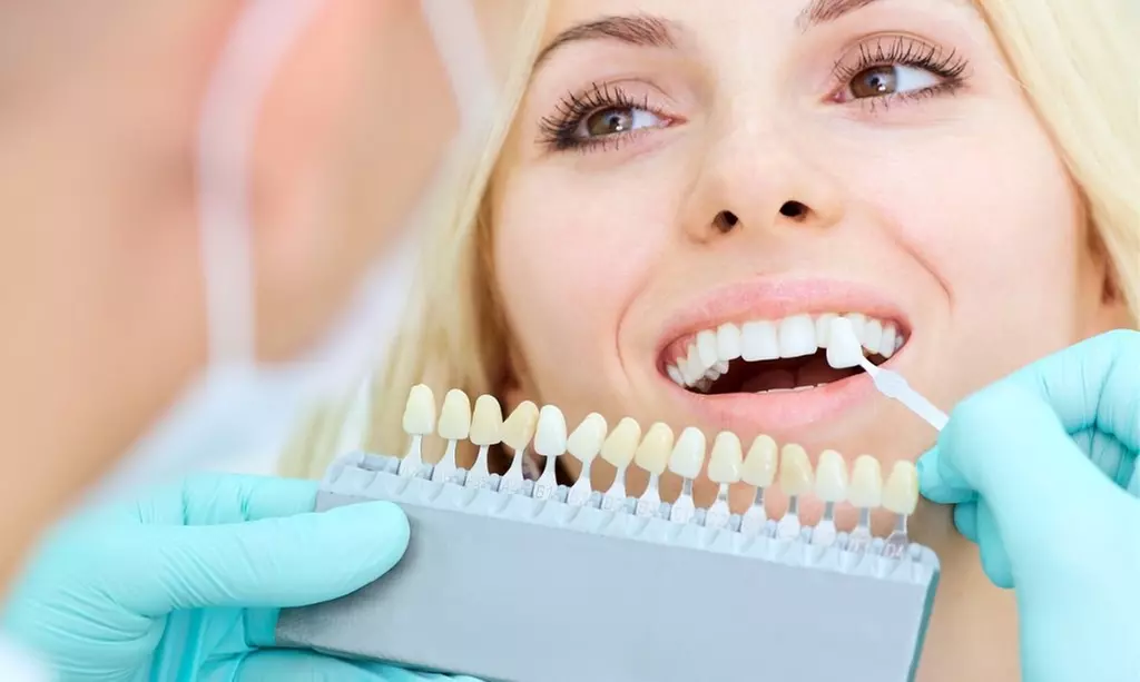 One or Two 30-Minute Express Deluxe Teeth Whitening Treatments at White Smiles Of Denton (Up to 48% Off) - Primary Image