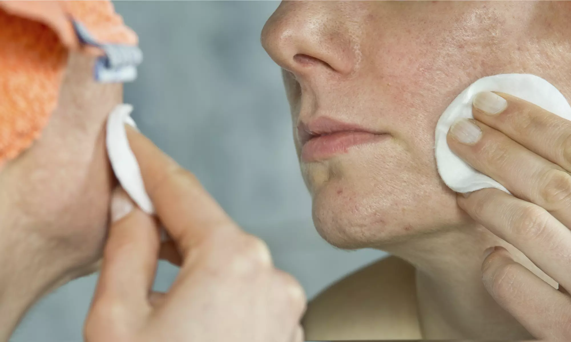 Up to 56% Off on Anti-Acne Facial Treatment at WayYoung - Primary Image