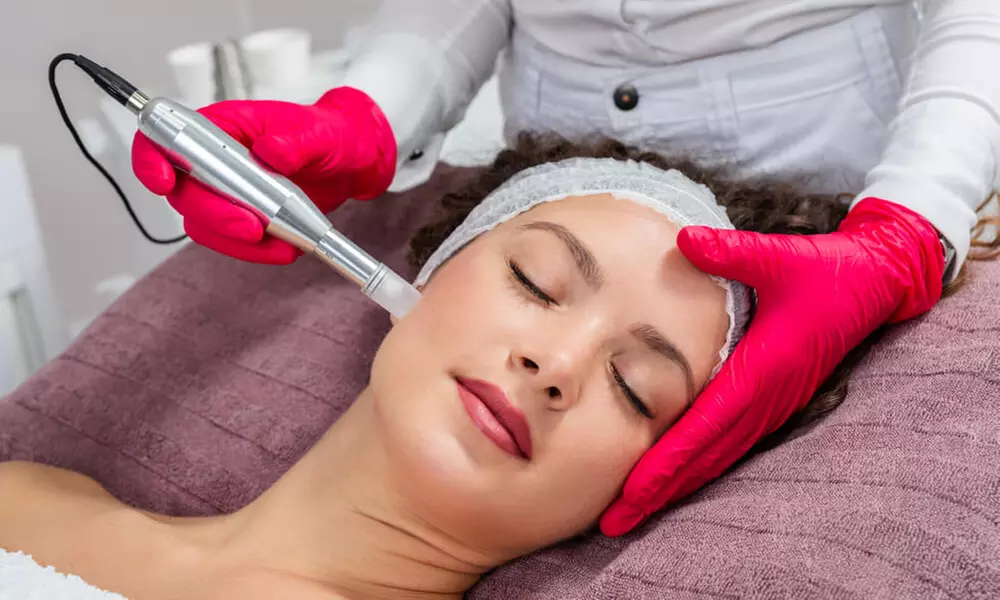 Enhance Skin with Micro-Needling Using Collagen or PRP
