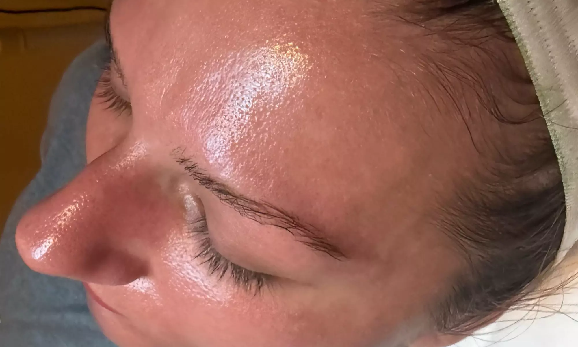 Get the Youthful Glow with Specialized Anti Aging Skin Treatment