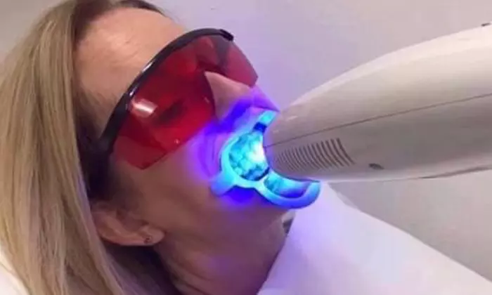 30-, 60-, or 90-Minute Teeth Whitening at One Beautiful Image (Up to 30% Off) - Primary Image