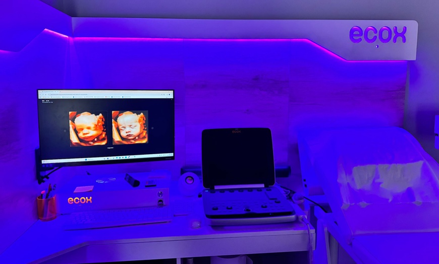 Image 5: ¡Conoce a tu bebé! Ecografía emocional 5D o 8K con vídeo y canastilla