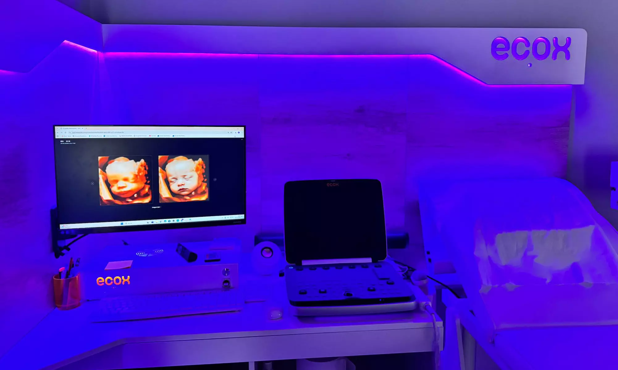 ¡Conoce a tu bebé! Ecografía emocional 5D o 8K con vídeo y canastilla