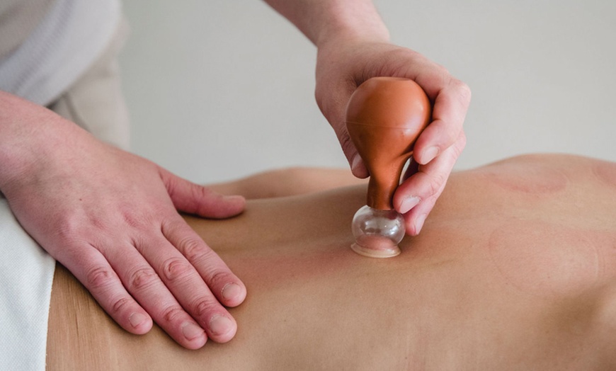 Image 5: Dag doffe huid, hallo stralend gezicht: 1, 3 of 5 IPL behandelingen